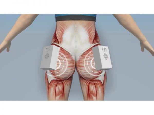 הצרת היקפים WONDER 5